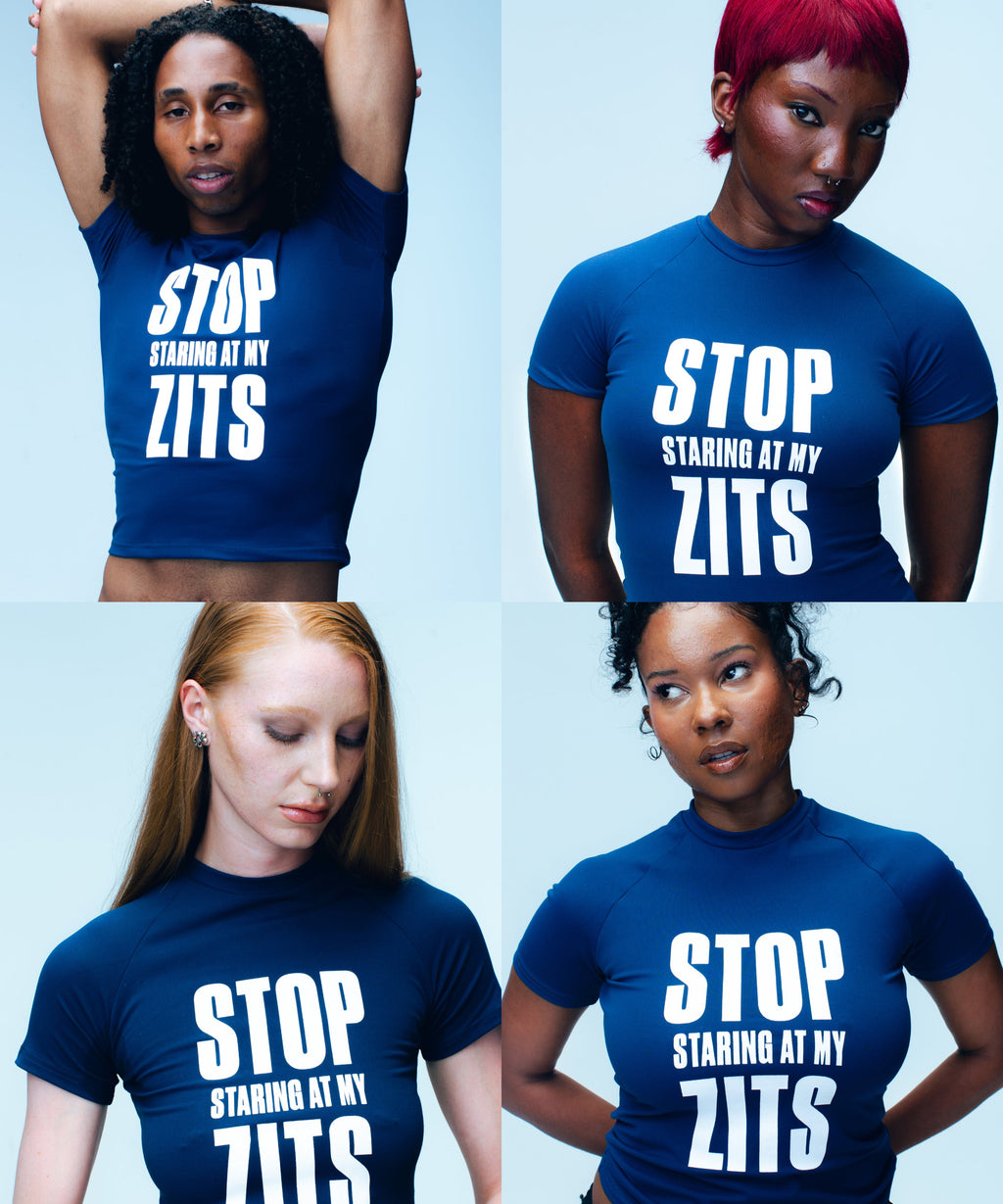 Four people modeling the Topicals navy Stop Staring At My Zits tee in studio shots, paired with the brand's acne and dark spot products.